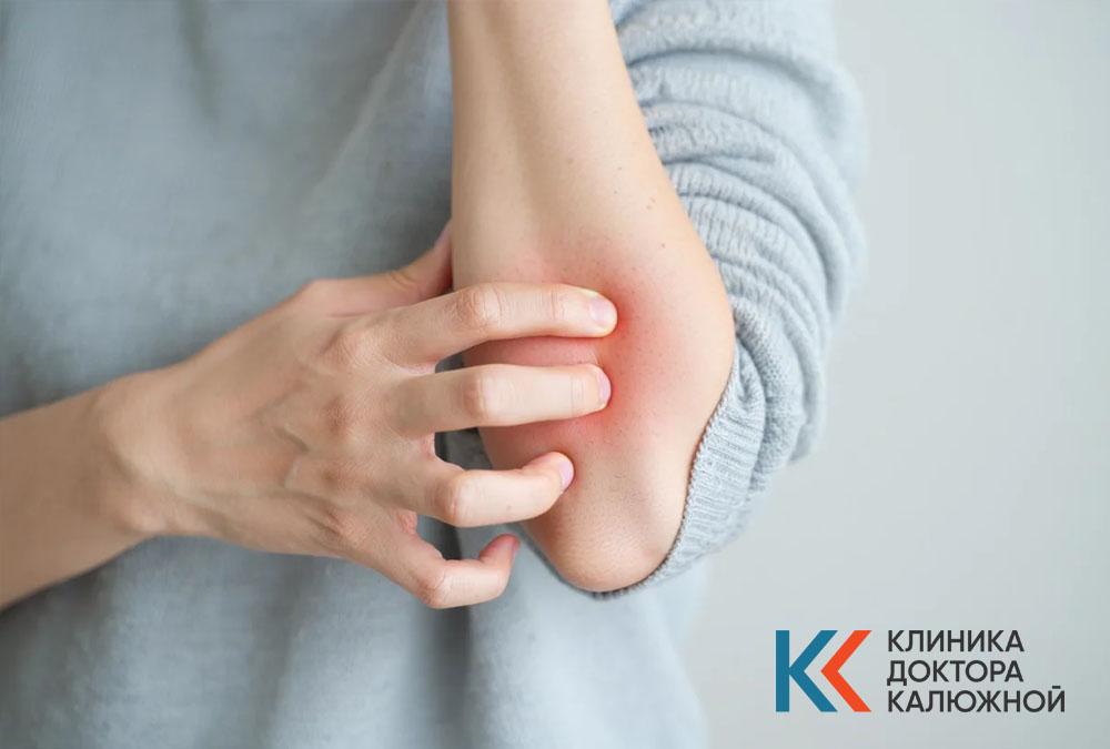 Аллергическая реакция